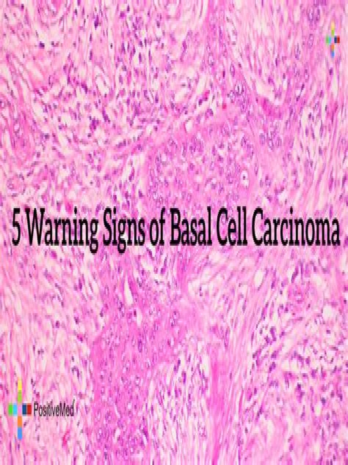 Can basal cell carcinoma be disfiguring