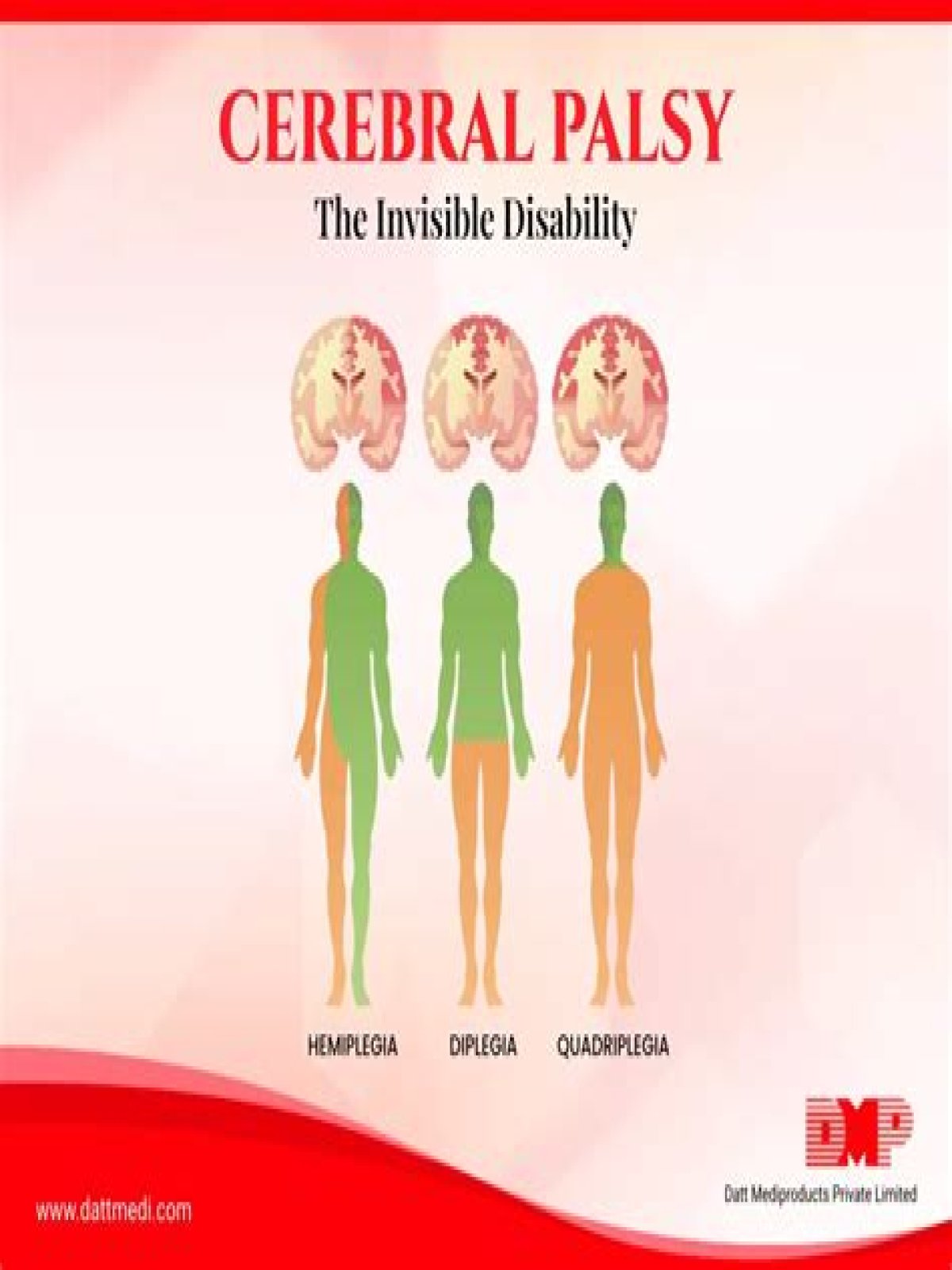 Is cerebral palsy and intellectual disability