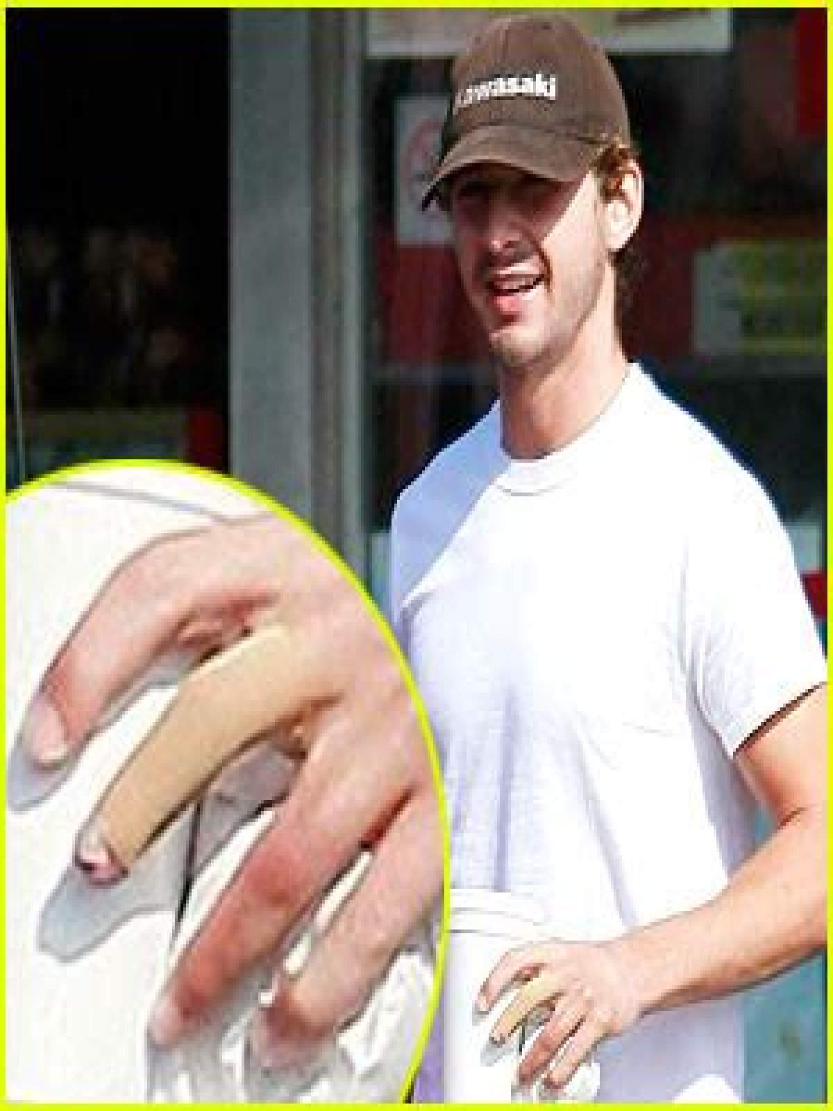 What happened to Shia LaBeoufs fingers
